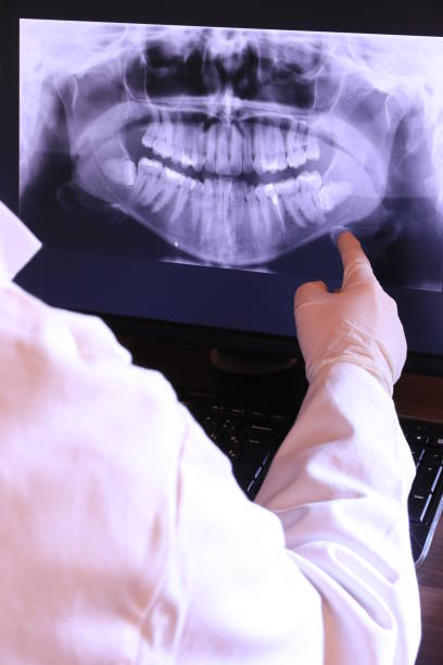 Best Emergency Dental Care for Broken or Chipped Teeth in Chicago, IL