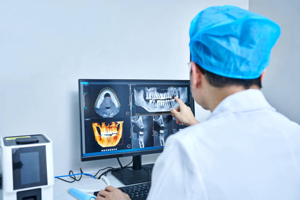 Best Emergency Wisdom Teeth Removal in Chicago, IL