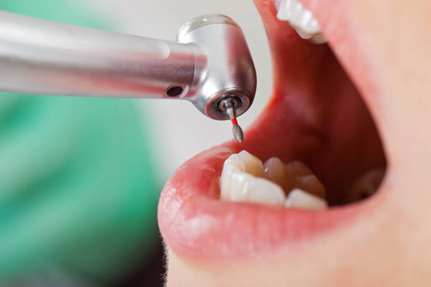 Best Emergency Treatment for Dental Infections or Abscesses in Chicago, IL